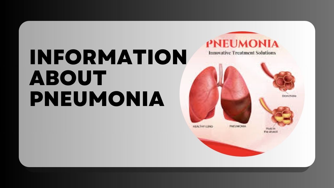 Great Information About Pneumonia 2023
